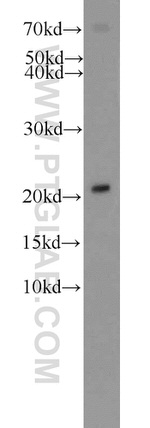 ITPA Antibody in Western Blot (WB)