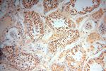 LAD1 Antibody in Immunohistochemistry (Paraffin) (IHC (P))