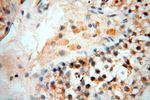 LAD1 Antibody in Immunohistochemistry (Paraffin) (IHC (P))