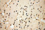 LAD1 Antibody in Immunohistochemistry (Paraffin) (IHC (P))