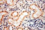 LAD1 Antibody in Immunohistochemistry (Paraffin) (IHC (P))