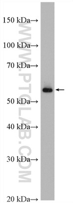 LAD1 Antibody in Western Blot (WB)