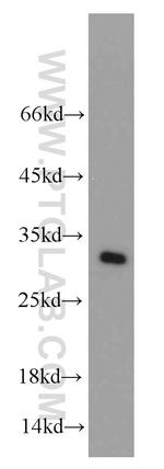 MRPS18B Antibody in Western Blot (WB)