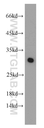 MRPS18B Antibody in Western Blot (WB)