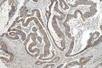 ACSF2 Antibody in Immunohistochemistry (Paraffin) (IHC (P))