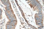 ACSF2 Antibody in Immunohistochemistry (Paraffin) (IHC (P))