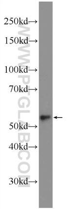 ACSF2 Antibody in Western Blot (WB)