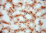 ATP6V1G1 Antibody in Immunohistochemistry (Paraffin) (IHC (P))