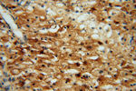 ATP6V1G1 Antibody in Immunohistochemistry (Paraffin) (IHC (P))