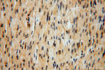 ATP6V1G1 Antibody in Immunohistochemistry (Paraffin) (IHC (P))