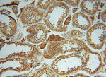 ATP6V1G1 Antibody in Immunohistochemistry (Paraffin) (IHC (P))