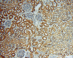 ATP6V1G1 Antibody in Immunohistochemistry (Paraffin) (IHC (P))