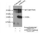 ATP6V1G1 Antibody in Immunoprecipitation (IP)