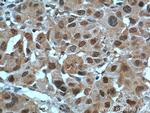 POLR1E Antibody in Immunohistochemistry (Paraffin) (IHC (P))