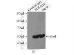 POLR1E Antibody in Immunoprecipitation (IP)