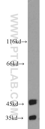 BAG1S/1M/1L Antibody in Western Blot (WB)