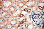 BAG1S/1M/1L Antibody in Immunohistochemistry (Paraffin) (IHC (P))