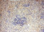 BAG1S/1M/1L Antibody in Immunohistochemistry (Paraffin) (IHC (P))