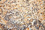 BAG1S/1M/1L Antibody in Immunohistochemistry (Paraffin) (IHC (P))