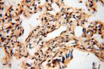 BAG1S/1M/1L Antibody in Immunohistochemistry (Paraffin) (IHC (P))