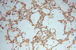 SMYD1 Antibody in Immunohistochemistry (Paraffin) (IHC (P))