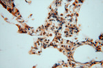 SMYD1 Antibody in Immunohistochemistry (Paraffin) (IHC (P))