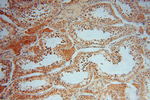 SMYD1 Antibody in Immunohistochemistry (Paraffin) (IHC (P))