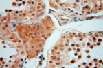 SMYD1 Antibody in Immunohistochemistry (Paraffin) (IHC (P))