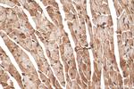 SMYD1 Antibody in Immunohistochemistry (Paraffin) (IHC (P))