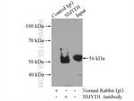 SMYD1 Antibody in Immunoprecipitation (IP)