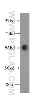 SMYD1 Antibody in Western Blot (WB)