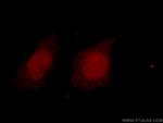 HDAC2 Antibody in Immunocytochemistry (ICC/IF)