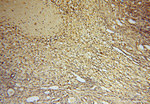 HDAC2 Antibody in Immunohistochemistry (Paraffin) (IHC (P))