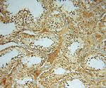 HDAC2 Antibody in Immunohistochemistry (Paraffin) (IHC (P))