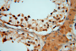 HDAC2 Antibody in Immunohistochemistry (Paraffin) (IHC (P))