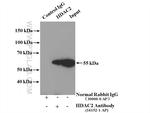 HDAC2 Antibody in Immunoprecipitation (IP)