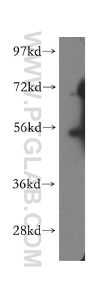 HDAC2 Antibody in Western Blot (WB)