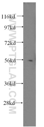 HDAC2 Antibody in Western Blot (WB)