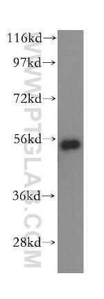 HDAC2 Antibody in Western Blot (WB)