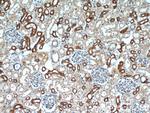 CCR2a Antibody in Immunohistochemistry (Paraffin) (IHC (P))