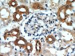 CCR2a Antibody in Immunohistochemistry (Paraffin) (IHC (P))