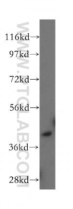 CCR2a Antibody in Western Blot (WB)