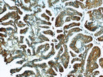 CCR2a Antibody in Immunohistochemistry (Paraffin) (IHC (P))