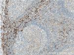 CCR2b Antibody in Immunohistochemistry (Paraffin) (IHC (P))