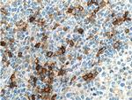 CCR2b Antibody in Immunohistochemistry (Paraffin) (IHC (P))