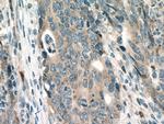 KRAS-2B Antibody in Immunohistochemistry (Paraffin) (IHC (P))