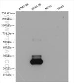 KRAS-2B Antibody in Western Blot (WB)