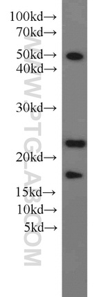 KRAS-2B Antibody in Western Blot (WB)