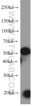 KRAS-2B Antibody in Western Blot (WB)