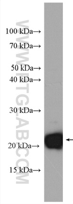 KRAS-2B Antibody in Western Blot (WB)